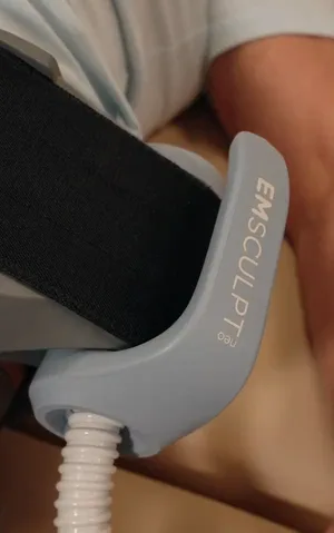 Emsculpt Neo for Arise Integrative Wellness